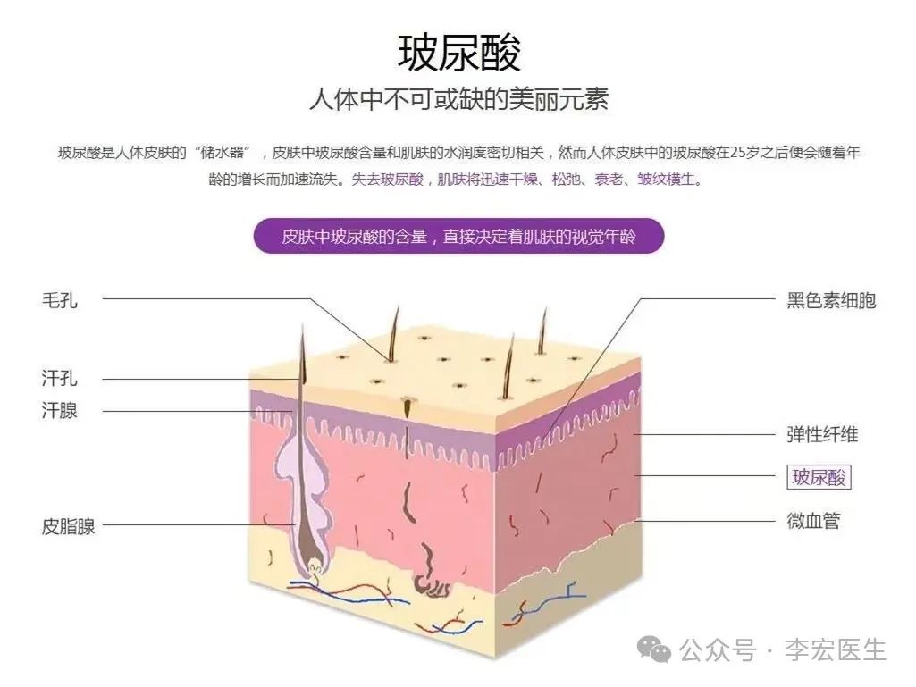 玻尿酸科普 | 解析市面上不同玻尿酸的区别及如何选择